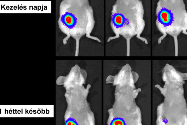 HUN-REN: új lendületet adhat a rák elleni harcnak a magyar kutatók fejlesztése
